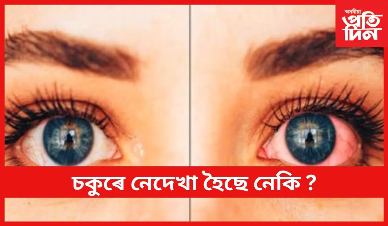চকুৰ উন্নত স্বাস্থ্যৰ বাবে ঘৰতে অৱলম্বন কৰক এইসমূহ উপায়
